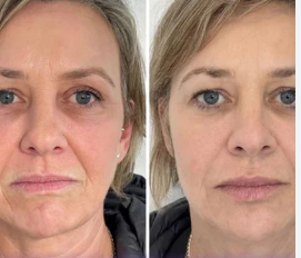 Mascarilla Facial de Colágeno CollagenGlow®